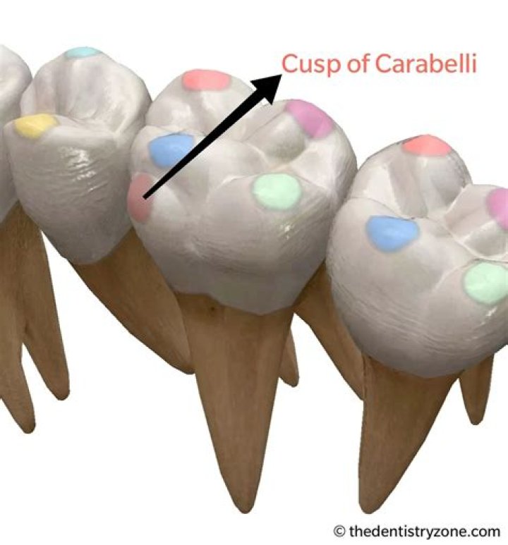 How common is cusp of Carabelli