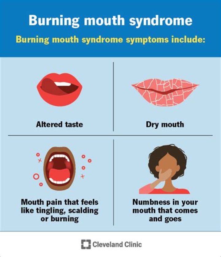 How do you get burning mouth syndrome
