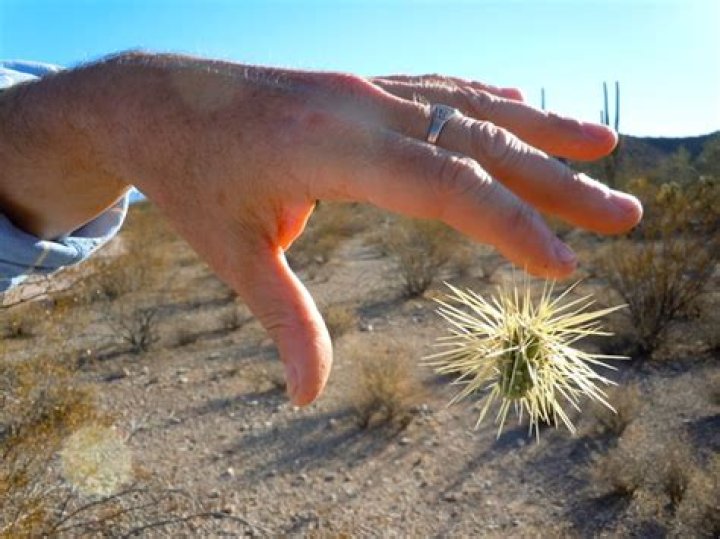 How do you get jumping cholla out of your skin