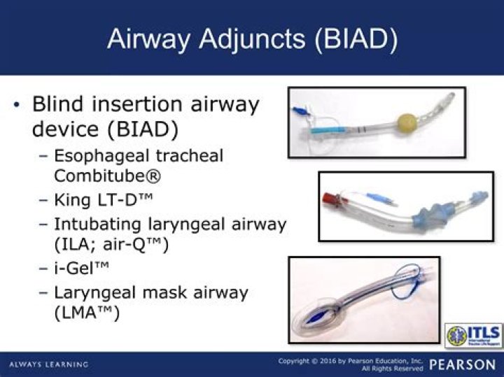 How do you install a King LT Airway