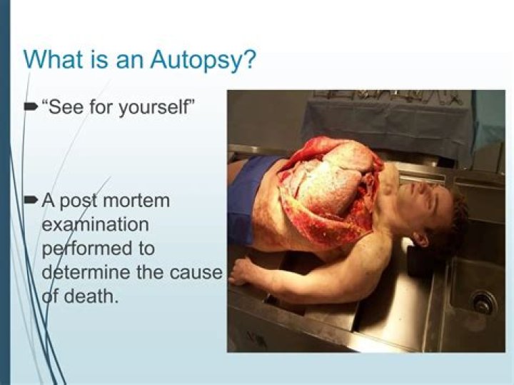 How is the brain removed during an autopsy