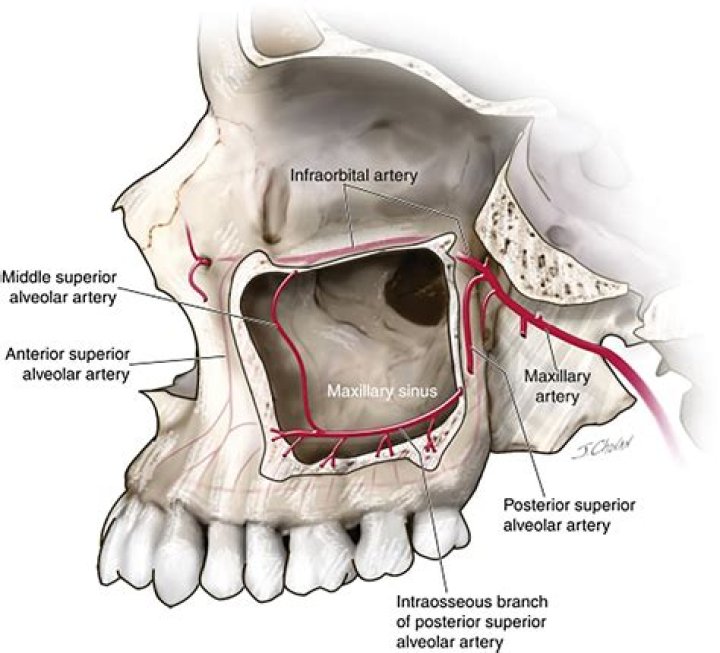 Is the maxillary sinus a bone