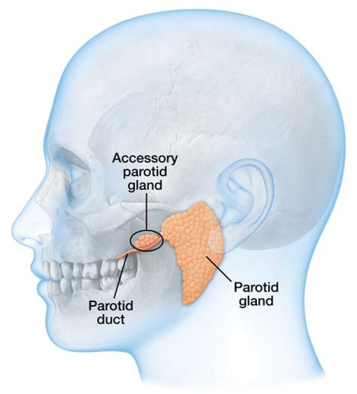 What causes enlarged parotid gland