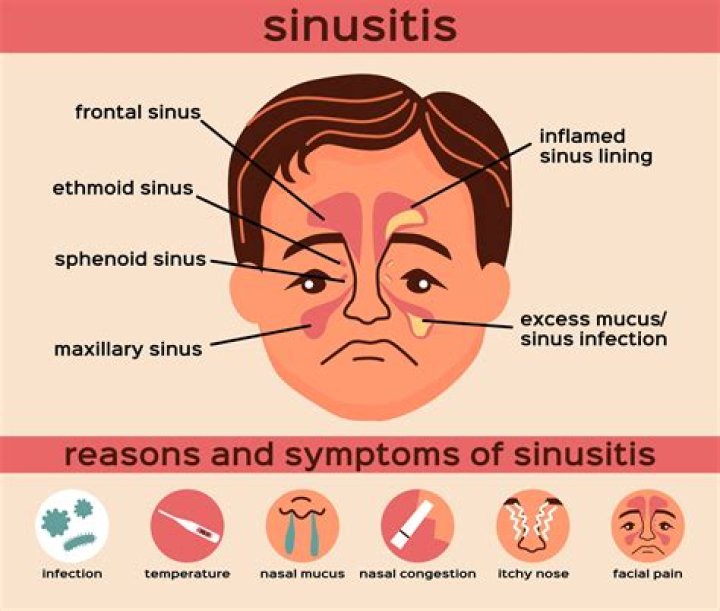 What is a sinus in bones