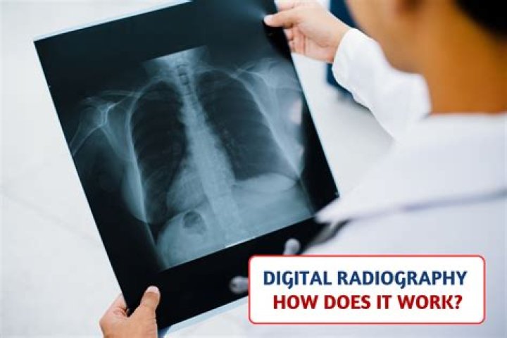 What is the purpose of preprocessing in digital radiography