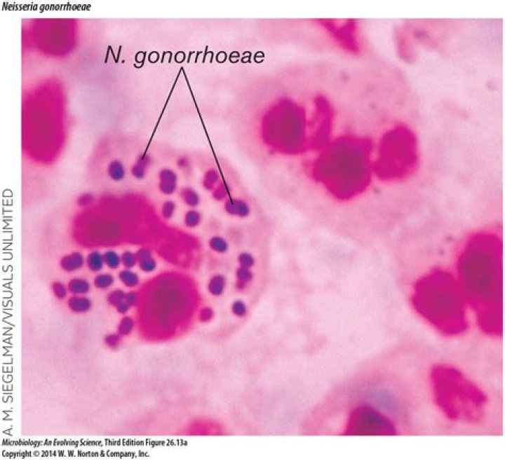 What is the shape of Neisseria gonorrhoeae