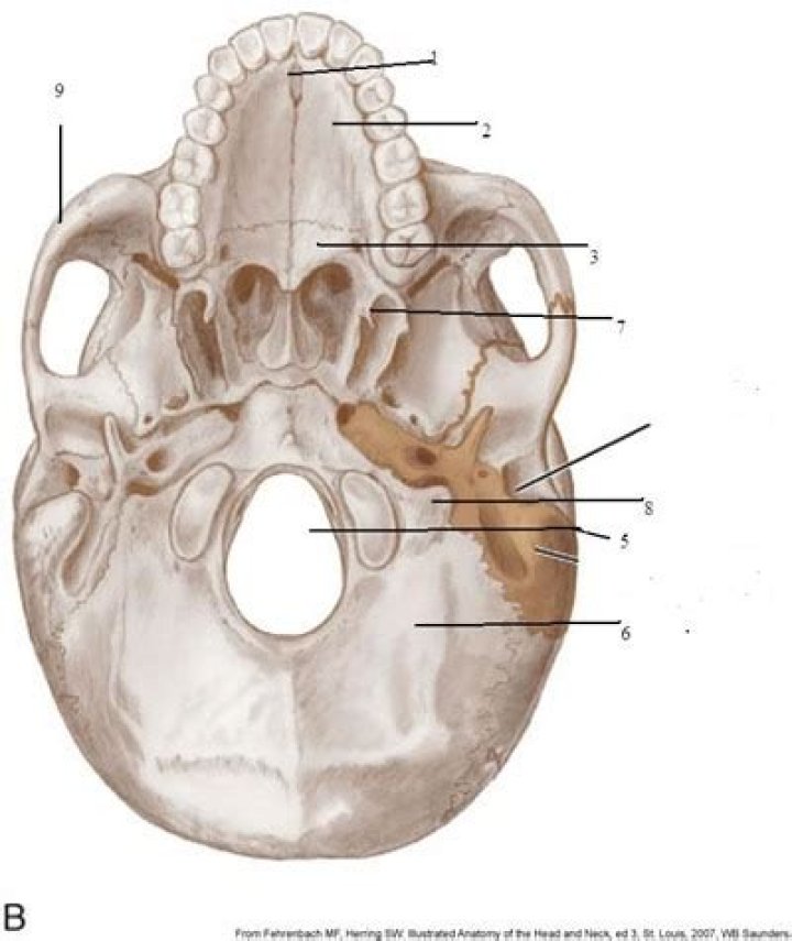Which type of fracture typically occurs at the base of the skull quizlet