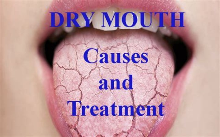 Why do Antimuscarinics cause dry mouth