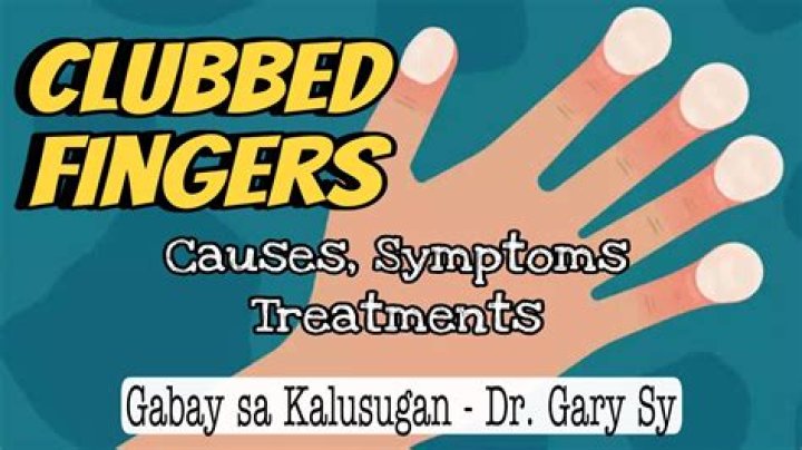 Why do CF patients have clubbed fingers